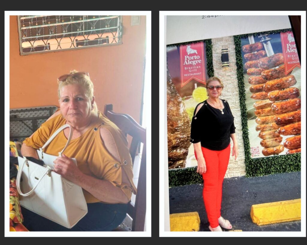 Antes y después de transformación metabólica y desinflamación celular en mujer de 62 años